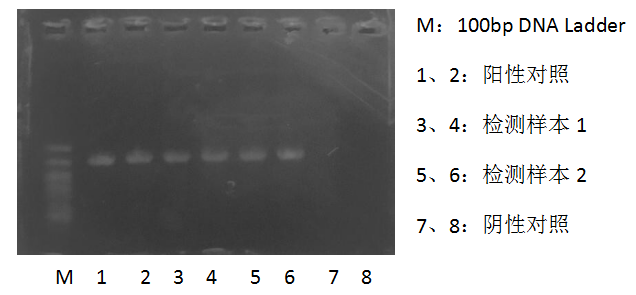 simgen-全血DNA小量试剂盒-pcr电泳图